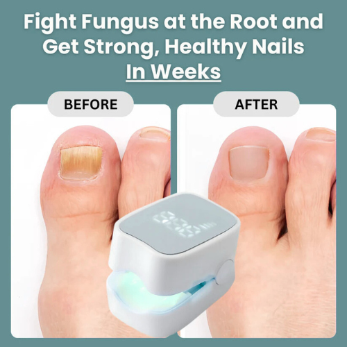 quenastore™ - Nail Fungus Laser Device